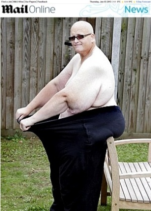 Paul Mason já chegou a pesar 445 kg. Após uma cirurgia de redução de estômago, perdeu 280 kg - Reprodução/Paul Nixon/Daily Mail