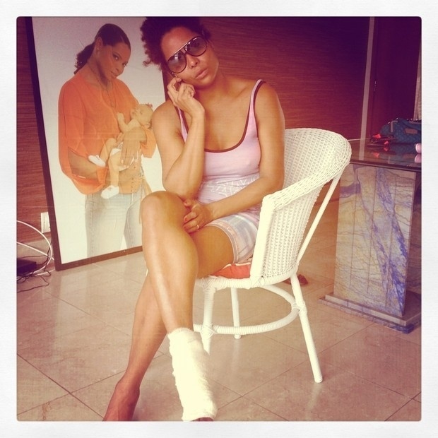 12.jan.2013 - Adriana Bombom publica uma foto mostrando o pé machucado