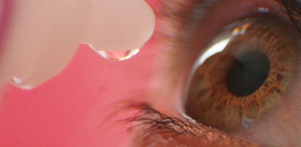 Conjuntivite é caracterizada pela inflamação da membrana conjuntiva que cobre o olho e a superfície interna das pálpebras; é importante buscar tratamento e orientação médica imediatamente - Danilo Verpa/Folhapress