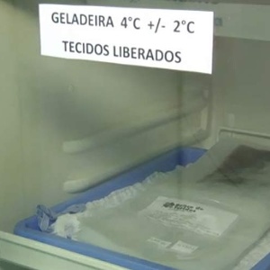 Lâminas com pele doada para transplante armazenadas no banco do Hospital das Clínicas de São Paulo - Reprodução/TV UOL