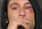 Foto: o estrago feito por José Aldo em Frankie Edgar encerra qualquer polêmica no UFC 156