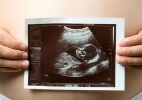 Festa do ultrassom é o novo chá de bebê das mães americanas - Shutterstock