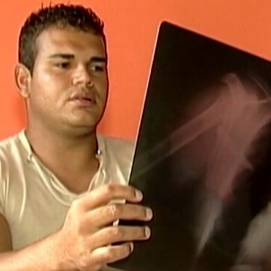 Claudinei Geraldo da Silva, 26, levou um susto ao fazer exame de raio-X na última quinta-feira - Reprodução de TV/TV Integração Araxá
