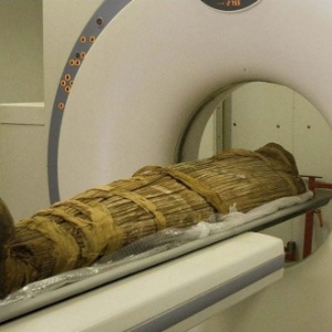 O estudo de múmias de diferentes regiões mostra que a aterosclerose era frequente no mundo antigo - Reuters/The Lancet