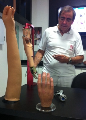 Nelson Nolé mostra modelo de braço biônico que poderá ser usado por David Sousa - UOL