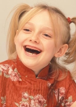 Dakota Fanning no Tumblr "Actresses Without Teeth" (http://actresseswithoutteeth.tumblr.com/), que reúne imagens com a versão "banguela" de atrizes, cantoras e famosas