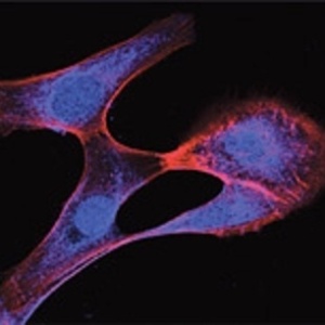 Descoberta do mecanismo de ação da ARHGAP21 nos processos de adesão e migração celular pode contribuir para o desenvolvimento de técnicas que impeçam a propagação de células cancerígenas - Divulgação/The Journal of Biological Chemistry