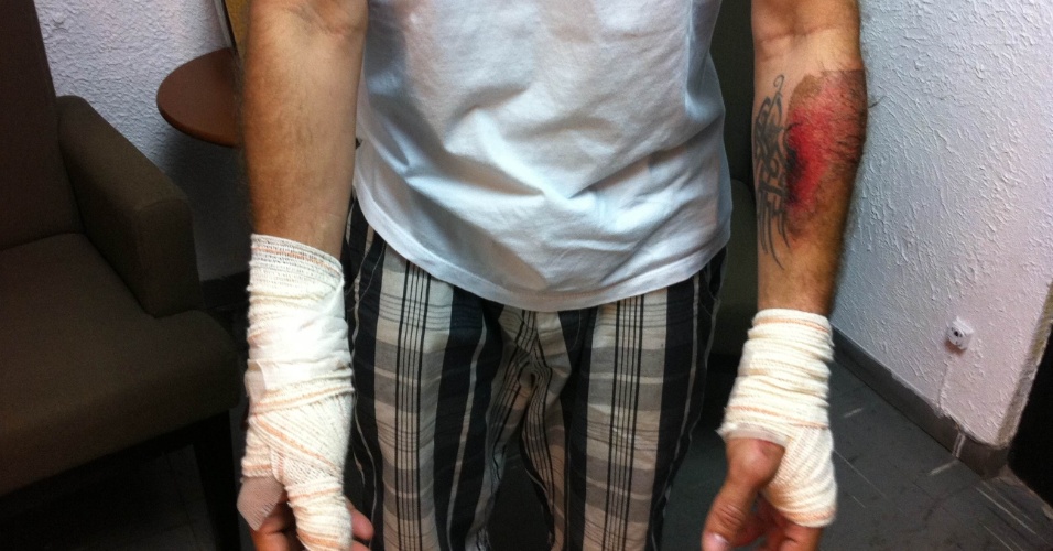 18.abr.2013 - O cantor Rafael Ilha exibe as mãos enfaixadas e os outros machucados após acidente de trânsito em São Paulo