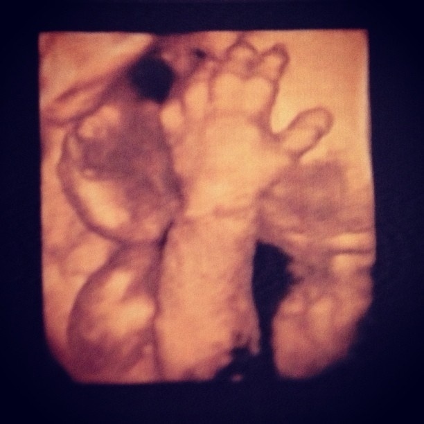 25.abr.2013 - Juliana Paes publica foto do ultrassom do filho Antônio