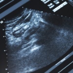 Thinkstock Thinkstock