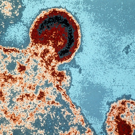 Imagem de microscópio mostra o vírus HIV se conectando à superfície de uma céula do sistema imune - AFP/Instituto Pasteur