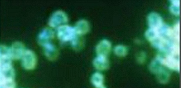 Imagem de microscópio de cepas causadoras de gonorreia resistente a antibióticos - CDC 
