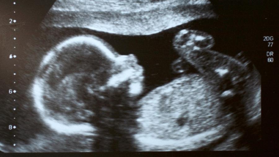 Ultrassom mostra bebê ainda no útero [imagem ilustrativa] - IStock