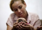 Um em cada 5 bebês com danos neurológicos por zika tem perímetro cefálico normal - Ueslei Marcelino/Reuters