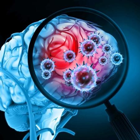 Investigações iniciais buscam caminhos para tratar danos da covid-19 no cérebro - iStock