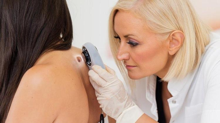Melanoma, Dermatology, Skin Cancer - Getty Images - Getty Images