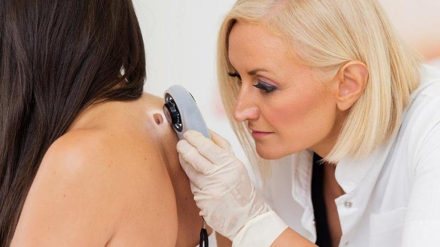 O melanoma é considerado o tipo mais agressivo de câncer de pele - Getty Images