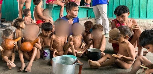 Crianças yanomamis desnutridas atendidas na unidade de saúde Surucucu, em Roraima 