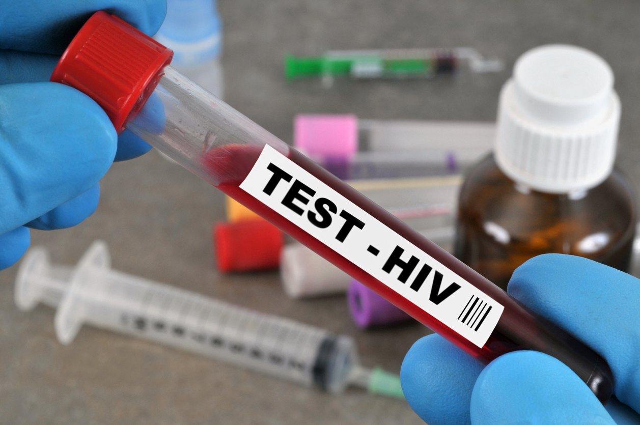 Segundo caso de cura do HIV é confirmado durante Congresso Mundial
