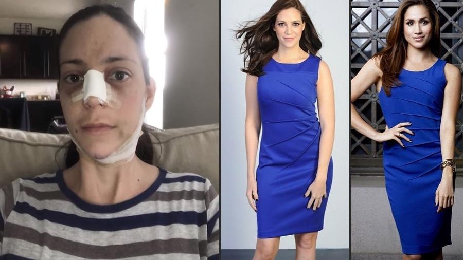 A advogada Sochi Greer passou por cirurgias para ficar parecida com Meghan Markle - Reprodução/Instagram 
