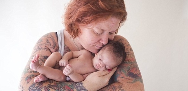 Christina Fischer posa com a filha Abigail Lynn, que nasceu com má-formação