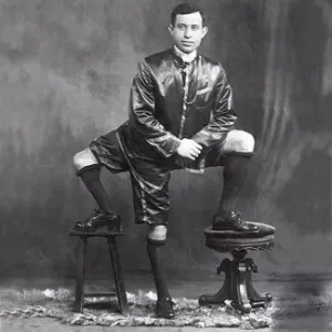 Três pernas: conheça Frank Lentini, italiano que, com perna a mais, virou artista de circo - Notícias - BOL