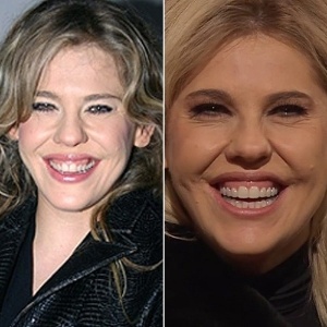 Reprodução/Dentes por Dentes e Reprodução/TV Cultura Reprodução/Dentes por Dentes e Reprodução/TV Cultura