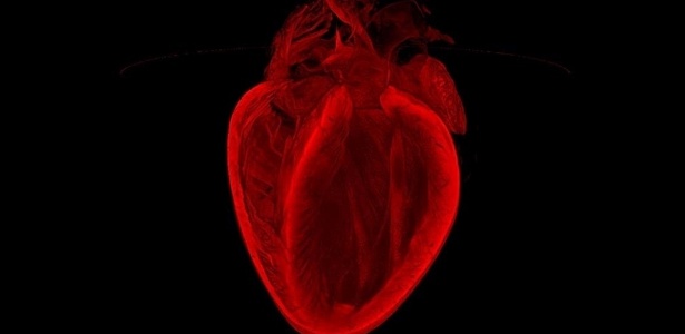 Reprodução/BOL/British Heart Foundation via BBC Reprodução/BOL/British Heart Foundation via BBC