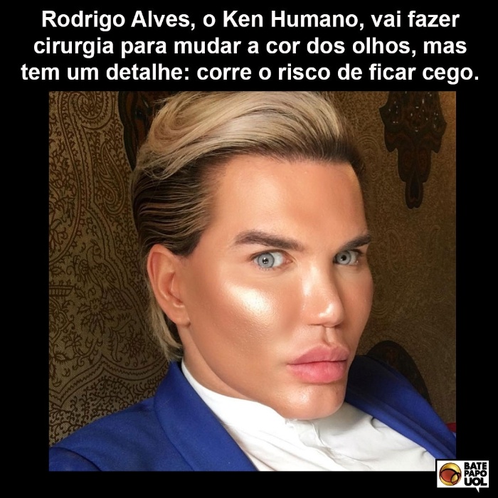 8.mai.2017 - Mais de 990 fãs do Bate-papo UOL no Facebook interagiram com a notícia sobre o brasileiro que vai fazer uma cirurgia arriscada para ficar parecido com o boneco Ken.