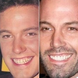 Reprodução/Pinterest Reprodução/Pinterest