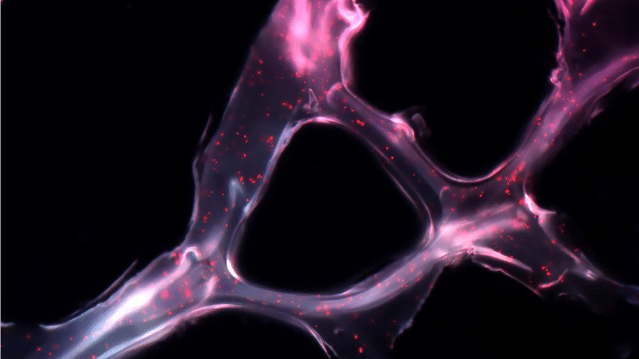 Sistema composto por duas sequências de microRNA em uma estrutura, semelhante a uma rede, projetada para suprimir o desenvolvimento de tumores. Imagem foi obtida com a técnica da fluorescência por pesquisadores do Massachusetts Institute of Technology (MIT) em 2017 - Reprodução/João Conde, Nuria Oliva e Natalie Artzi