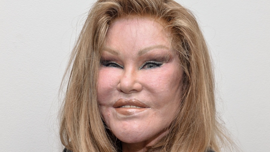 Jocelyn Wildenstein era conhecida pela aparência conquistada após várias cirurgias plásticas