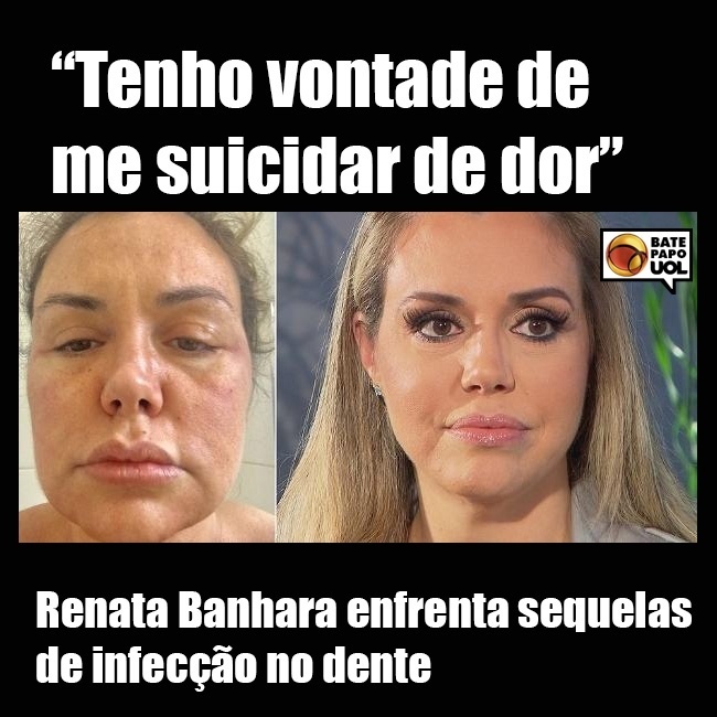 28.out.2017 - O post mais curtido foi o da modelo Renata Banhara, que ficou com o rosto paralisado e teve que enfrentar cirurgias para corrigir as sequelas deixadas por uma infecção no dente.