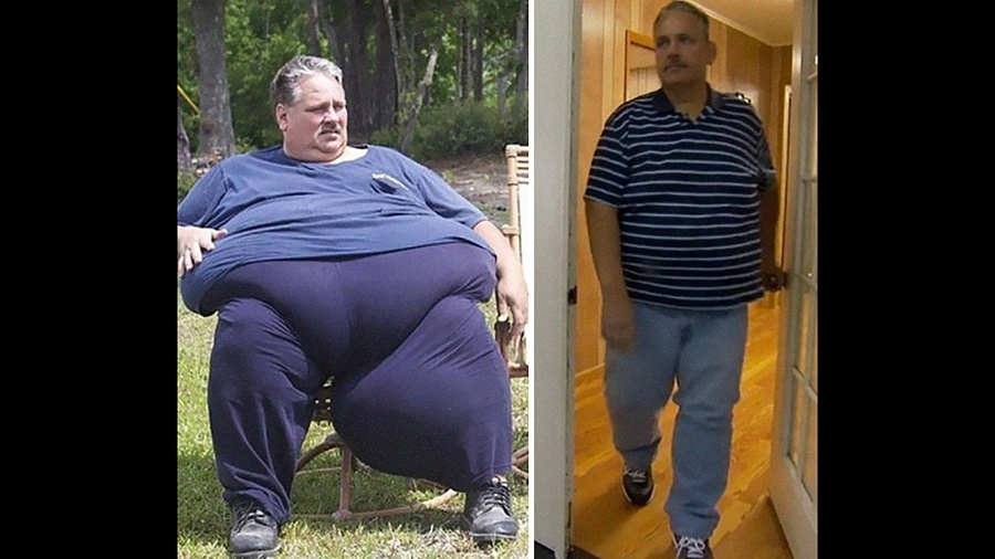 Fotos: Perderam até 200 kg: os mais inacreditáveis 