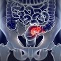 iStock