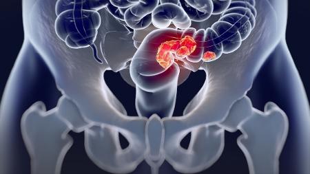 iStock
