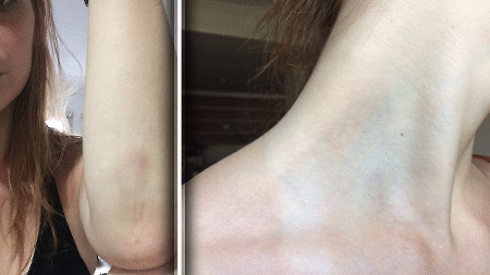 Reprodução/Facebook/ca.ffroes