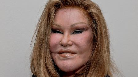 Grant Lamos IV/Getty Images