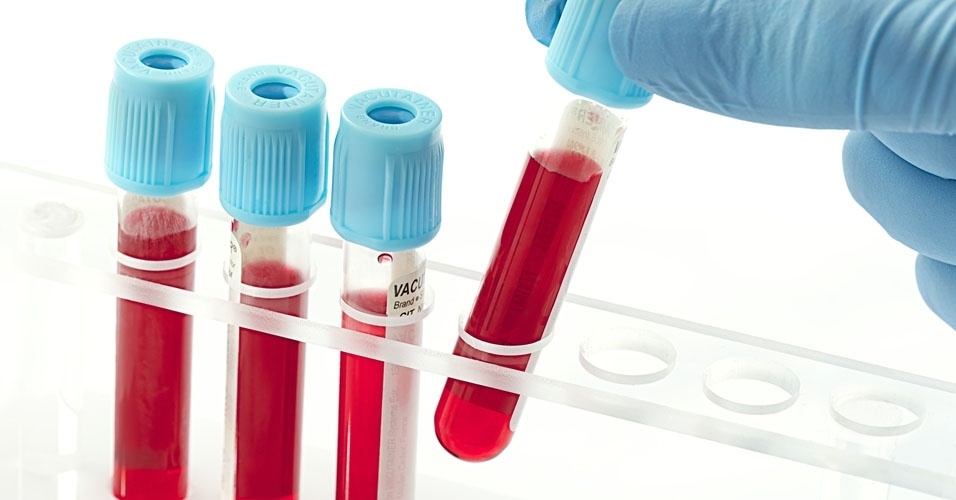 O Que Significa Normocitose E Normocromia No Exame De Sangue