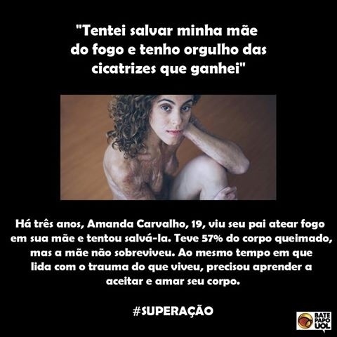 10.ago.2017 - O sacrifício de Amanda Carvalho pela mãe comoveu mais de 270 fãs do Bate-papo UOL.