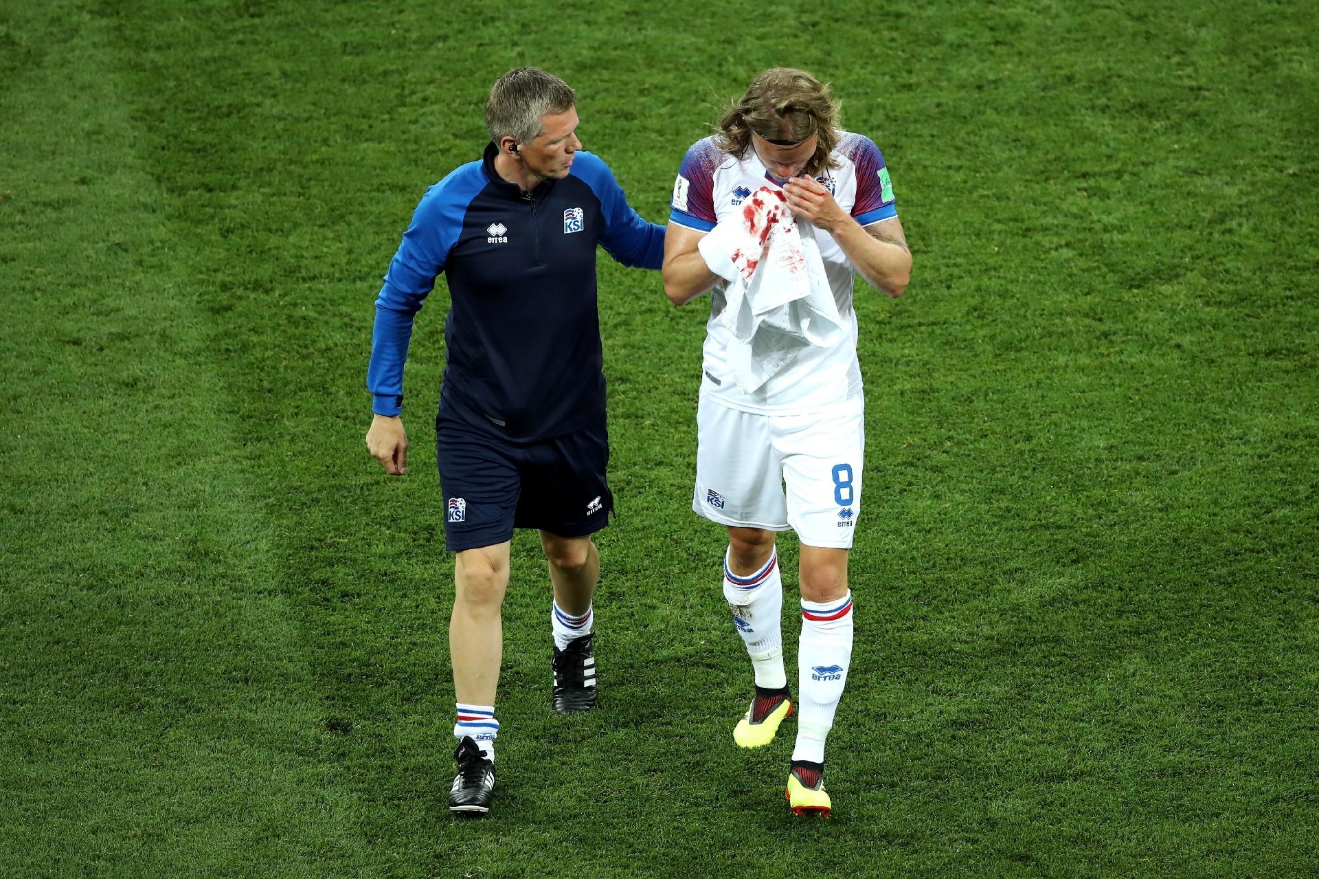 O islandês Birkir Bjarnason sai de campo com o nariz sangrando - Clive Mason/Getty Images