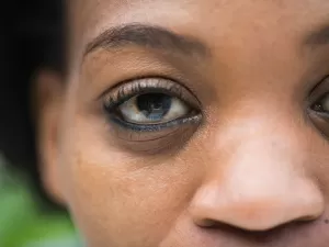 9 coisas que até quem é jovem precisa saber sobre o glaucoma