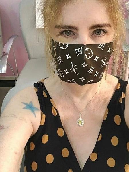 Isis de Oliveira desabafou nas redes sociais sobre dor ao remover tatuagens  - Reprodução/Instagram