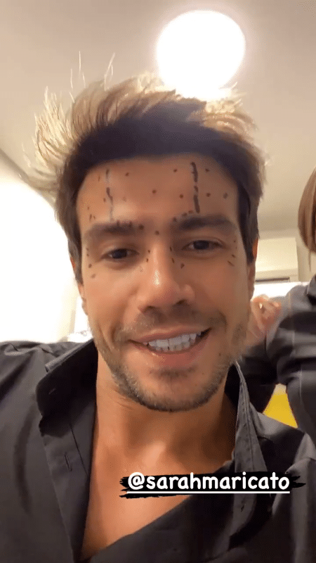 Mariano fez botox e mostrou no Instagram Stories - Reprodução/Instagram - Reprodução/Instagram