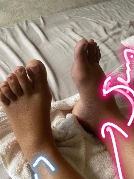 Cantora elogia profissional depois de drenagem  - Reprodução instagram  - Reprodução instagram 