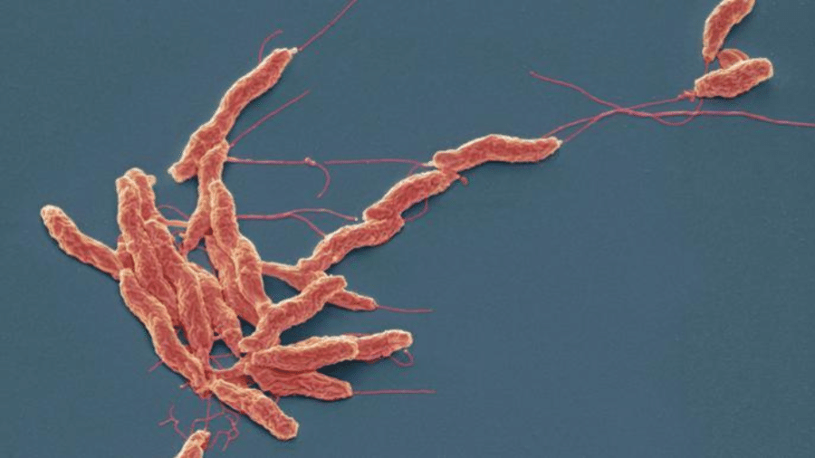 Bactérias Campylobacter, que usualmente provocam diarreia, são uma das causas associadas à síndrome  - Getty Images