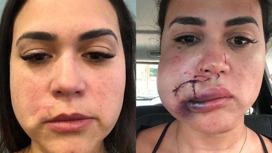 Milka Borges foi agredida no restaurante Iulia, no Jockey Club - Reprodução/Instagram