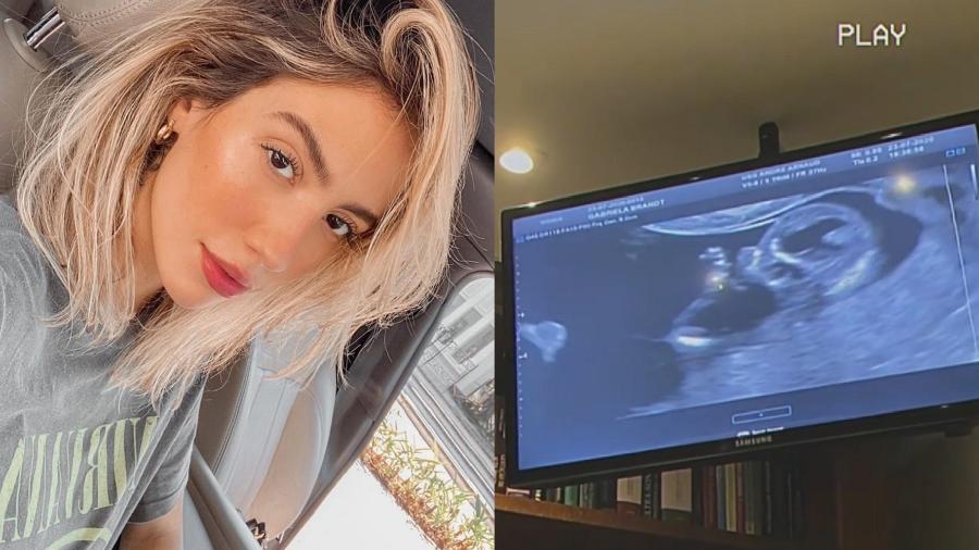 Gabi Brandt mostra imagens de ultrassom do seu segundo filho - Reprodução/Instagram