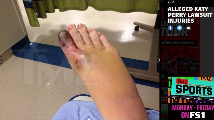 Mulher teve um dedo amputado após se ferir no palco da cantora Katy Perry - Reprodução/TMZ - Reprodução/TMZ