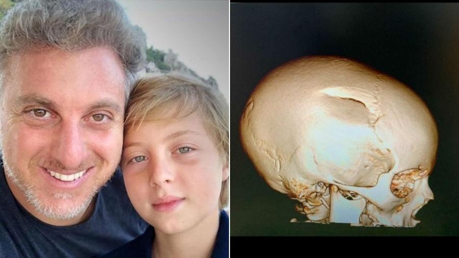Luciano Huck com o filho Benício e o exame do crânio do garoto após o acidente - Reprodução/Instagram